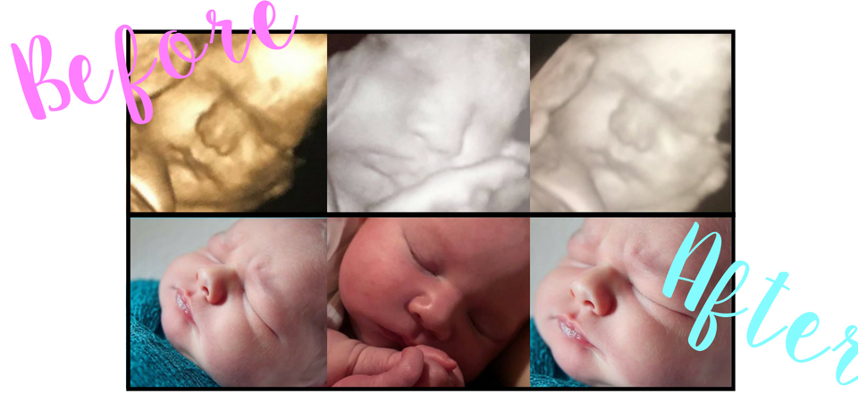 Packages Peek A Boo 3d 4d Ultrasound And Baby Boutique